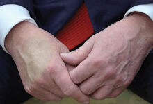 The weakness of America’s “strong leader”