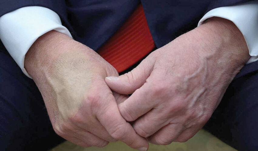 The weakness of America’s “strong leader” The weakness of America’s “strong leader”