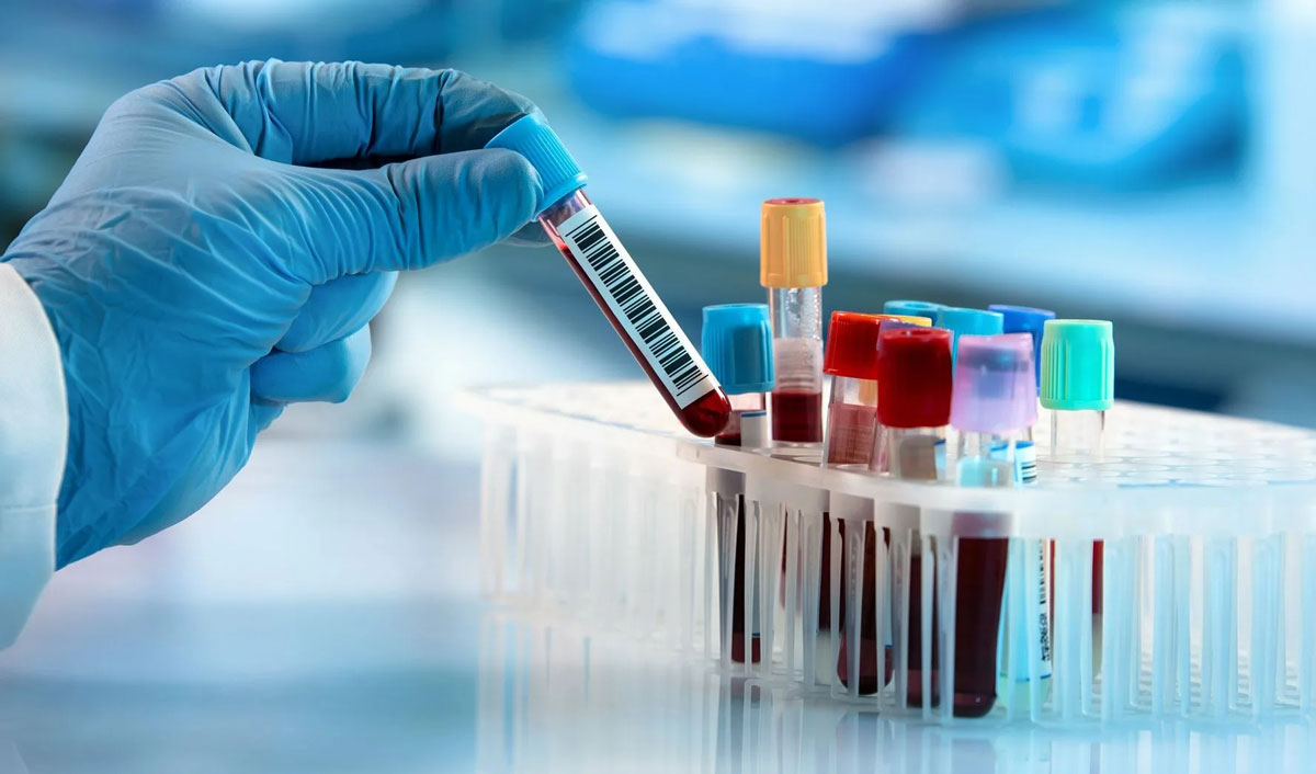 New cases of Cu fever detected in Moldova